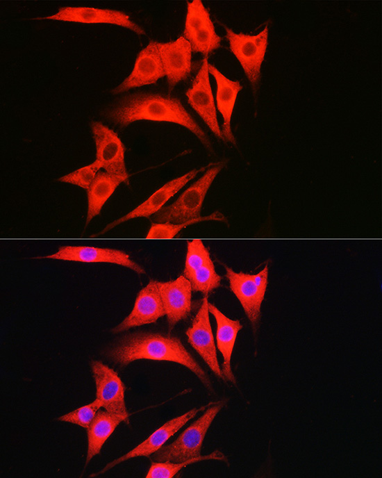 Immunofluorescence analysis of NIH/3T3 cells using CASP1 Polyclonal Antibody at dilution of 1:50 (40x lens). Blue: DAPI for nuclear staining.