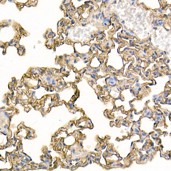 Immunohistochemistry of paraffin-embedded mouse lung using ICAM1 Polyclonal Antibody at dilution of 1:100 (40x lens).Perform high pressure antigen retrieval with 10 mM citrate buffer pH 6.0 before commencing with IHC staining protocol.