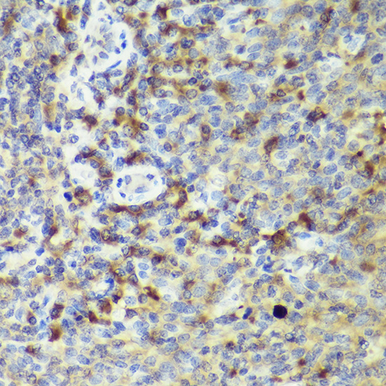 Immunohistochemistry of paraffin-embedded human tonsil using IL18 Polyclonal Antibody at dilution of 1:50 (40x lens).Perform high pressure antigen retrieval with 10 mM citrate buffer pH 6.0 before commencing with IHC staining protocol.