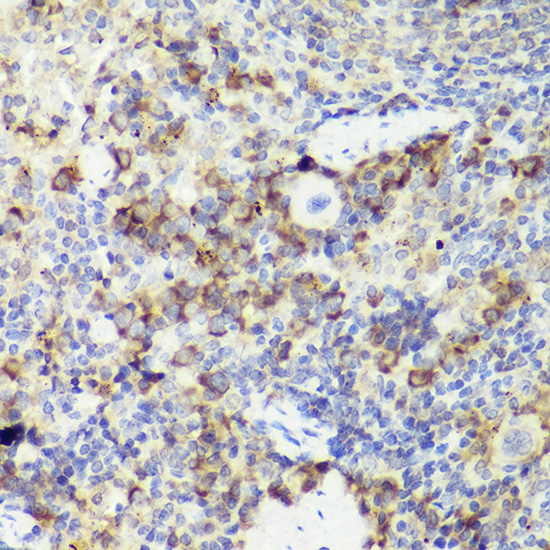 Immunohistochemistry of paraffin-embedded mouse spleen using IL18 Polyclonal Antibody at dilution of 1:50 (40x lens).Perform high pressure antigen retrieval with 10 mM citrate buffer pH 6.0 before commencing with IHC staining protocol.