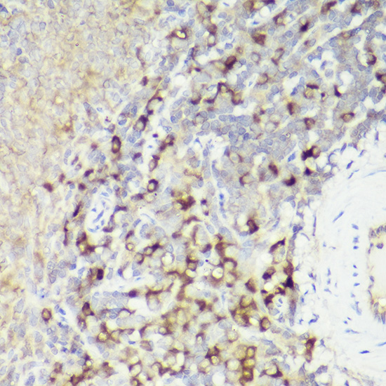 Immunohistochemistry of paraffin-embedded rat spleen using IL18 Polyclonal Antibody at dilution of 1:50 (40x lens).Perform high pressure antigen retrieval with 10 mM citrate buffer pH 6.0 before commencing with IHC staining protocol.