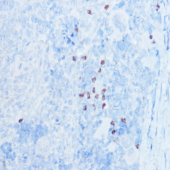 Immunohistochemistry of paraffin-embedded rat spleen using S100A8 Polyclonal Antibody at dilution of 1:50 (40x lens).Perform high pressure antigen retrieval with 10 mM citrate buffer pH 6.0 before commencing with IHC staining protocol.