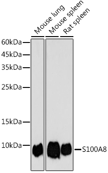 Western blot analysis of extracts of various cell lines using S100A8 Polyclonal Antibody at 1:1000 dilution.