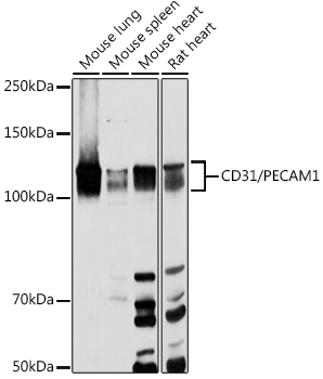 Western blot analysis of extracts of various cell lines using CD31/PECAM1 Polyclonal Antibody at 1:1000 dilution.