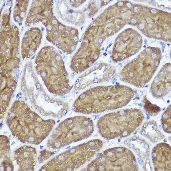 Immunohistochemistry of paraffin-embedded mouse kidney using PYCARD Polyclonal Antibody at dilution of 1:100 (40x lens).Perform high pressure antigen retrieval with 10 mM citrate buffer pH 6.0 before commencing with IHC staining protocol.