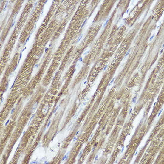 Immunohistochemistry of paraffin-embedded rat heart using PYCARD Polyclonal Antibody at dilution of 1:100 (40x lens).Perform high pressure antigen retrieval with 10 mM citrate buffer pH 6.0 before commencing with IHC staining protocol.