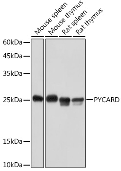 Western blot analysis of extracts of various cell lines using PYCARD Polyclonal Antibody at 1:1000 dilution.