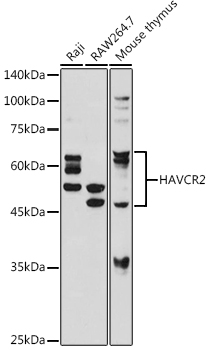 Western blot analysis of extracts of various cell lines using TIM-3/HAVCR2 Polyclonal Antibody at 1:1000 dilution.