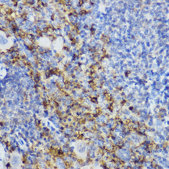 Immunohistochemistry of paraffin-embedded mouse spleen using CD152/CTLA-4 Polyclonal Antibody at dilution of 1:200 (40x lens).Perform high pressure antigen retrieval with 10 mM citrate buffer pH 6.0 before commencing with IHC staining protocol.