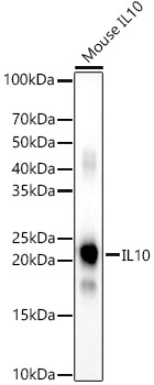 Western blot analysis of various lysates using IL10 Polyclonal Antibody at 1:2000 dilution.