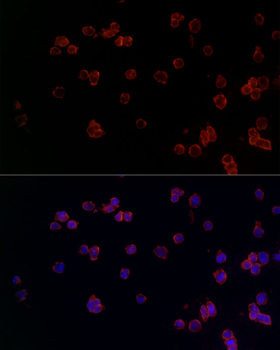 Immunofluorescence analysis of 293T cells using GPBAR1 Polyclonal Antibody at dilution of 1:100 (40x lens). Blue: DAPI for nuclear staining.