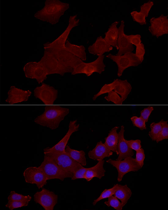 Immunofluorescence analysis of HCT 116 cells using GPBAR1 Polyclonal Antibody at dilution of 1:100 (40x lens). Blue: DAPI for nuclear staining.