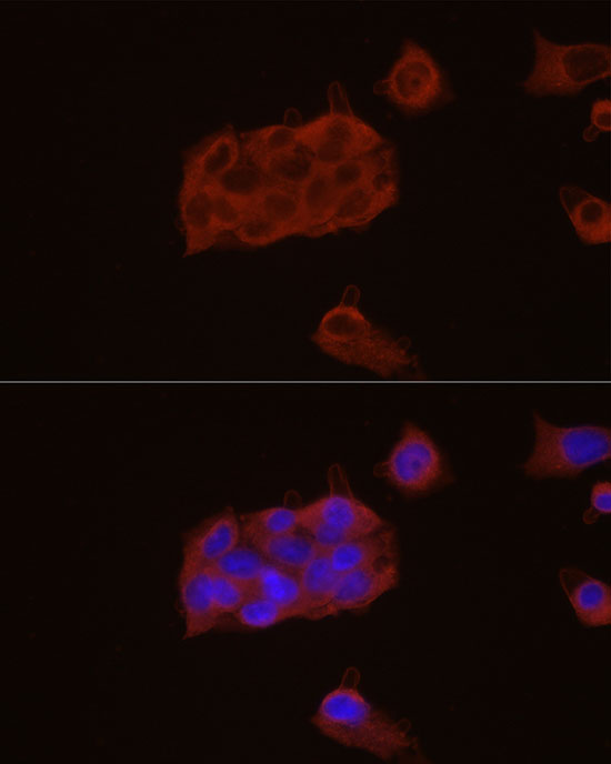 Immunofluorescence analysis of HepG2 cells using GPBAR1 Polyclonal Antibody at dilution of 1:100 (40x lens). Blue: DAPI for nuclear staining.