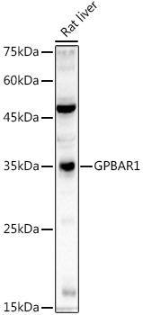 Western blot analysis of extracts of Rat liver using GPBAR1 Polyclonal Antibody at 1:1000 dilution.