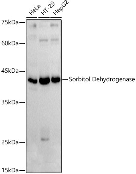 Western blot analysis of extracts of various cell lines using Sorbitol Dehydrogenase Polyclonal Antibody at 1:1000 dilution.