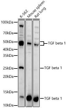 Western blot analysis of various lysates using TGF beta 1 Polyclonal Antibody at 1:2000 dilution.