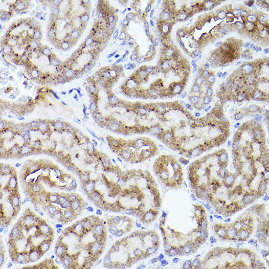 Immunohistochemistry of paraffin-embedded mouse kidney using THBS1 Polyclonal Antibody at dilution of 1:50 (40x lens).Perform high pressure antigen retrieval with 10 mM citrate buffer pH 6.0 before commencing with IHC staining protocol.