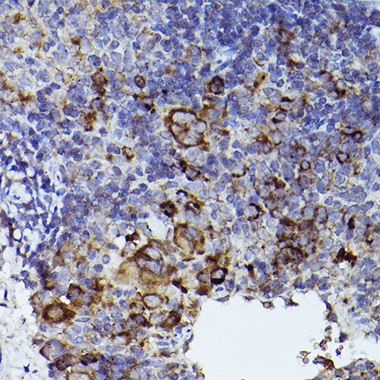 Immunohistochemistry of paraffin-embedded mouse spleen using THBS1 Polyclonal Antibody at dilution of 1:50 (40x lens).Perform high pressure antigen retrieval with 10 mM citrate buffer pH 6.0 before commencing with IHC staining protocol.