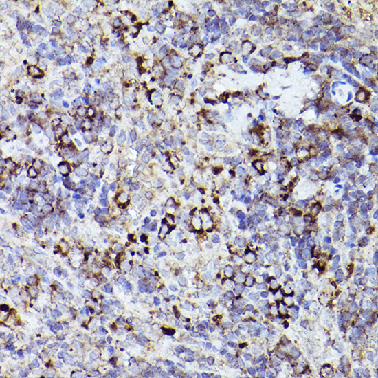 Immunohistochemistry of paraffin-embedded rat spleen using THBS1 Polyclonal Antibody at dilution of 1:50 (40x lens).Perform high pressure antigen retrieval with 10 mM citrate buffer pH 6.0 before commencing with IHC staining protocol.