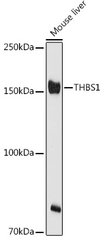 Western blot analysis of extracts of Mouse liver using THBS1 Polyclonal Antibody at 1:500 dilution.