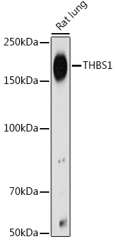 Western blot analysis of extracts of Rat lung using THBS1 Polyclonal Antibody at 1:500 dilution.