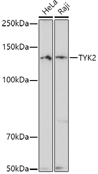 Western blot analysis of extracts of various cell lines using TYK2 Polyclonal Antibody at 1:500 dilution.