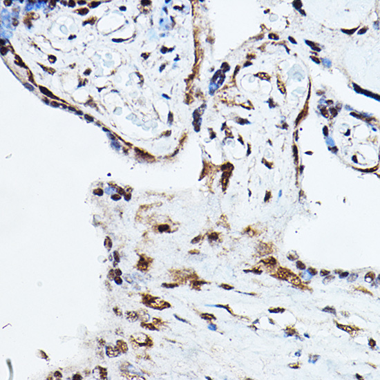 Immunohistochemistry of paraffin-embedded human placenta using Ubiquitin Polyclonal Antibody at dilution of 1:100 (40x lens).Perform high pressure antigen retrieval with 10 mM citrate buffer pH 6.0 before commencing with IHC staining protocol.