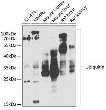 Western blot analysis of extracts of various cell lines using Ubiquitin Polyclonal Antibody at 1:1000 dilution.