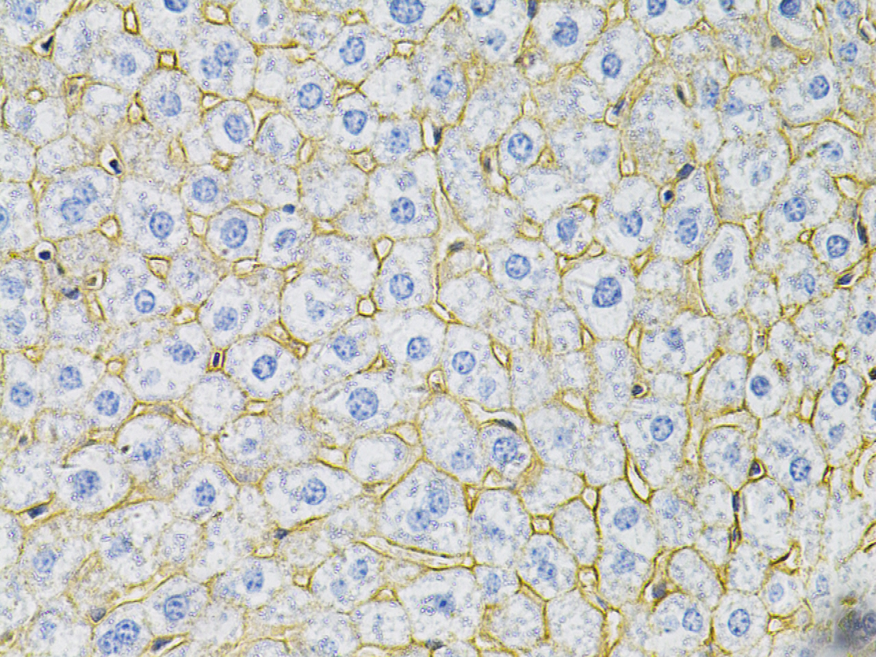 Immunohistochemistry of paraffin-embedded Mouse liver using N-Cadherin Polyclonal Antibody at dilution of 1:100 (40x lens).Perform microwave antigen retrieval with 10 mM PBS buffer pH 7.2 before commencing with IHC staining protocol.