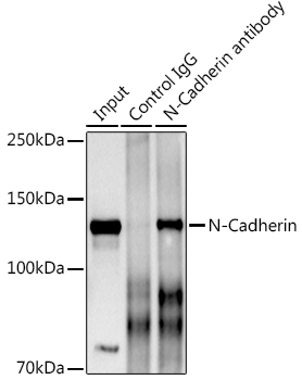 Immunoprecipitation analysis of 600ug extracts of Mouse brain using 3ug N-Cadherin Polyclonal Antibody. Western blot was performed from the immunoprecipitate using N-Cadherin Polyclonal Antibody at a dilution of 1:1000.