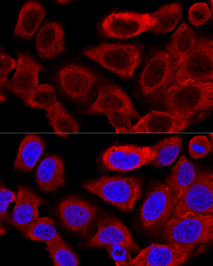 Confocal immunofluorescence analysis of U2OS cells using DRP1 Polyclonal Antibody at dilution of 1:200. Blue: DAPI for nuclear staining.