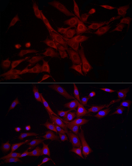 Immunofluorescence analysis of NIH/3T3 cells using DRP1 Polyclonal Antibody at dilution of 1:200 (40x lens). Blue: DAPI for nuclear staining.