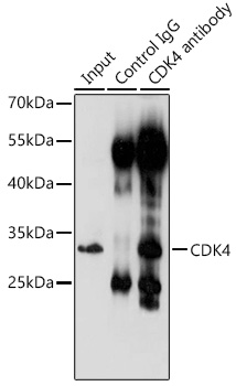 Immunoprecipitation analysis of 200ug extracts of 293T cells using 3ug CDK4 Polyclonal Antibody. Western blot was performed from the immunoprecipitate using CDK4 Polyclonal Antibody at a dilution of 1:1000.