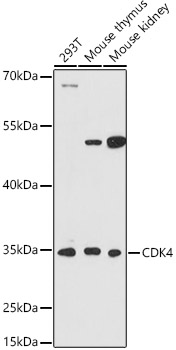 Western blot analysis of extracts of various cell lines using CDK4 Polyclonal Antibody at 1:1000 dilution.
