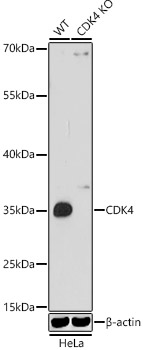 Western blot analysis of extracts from wild type(WT) and CDK4 knockout (KO) HeLa cells using CDK4 Polyclonal Antibody at 1:1000 dilution.