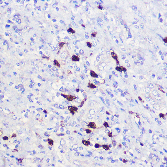 Immunohistochemistry of paraffin-embedded human liver using CDKN1A/p21CIP1 Polyclonal Antibody at dilution of 1:100 (40x lens).Perform high pressure antigen retrieval with 10 mM citrate buffer pH 6.0 before commencing with IHC staining protocol.