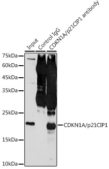 Immunoprecipitation analysis of 300ug extracts of MCF7 cells using 3ug CDKN1A/p21CIP1 Polyclonal Antibody. Western blot was performed from the immunoprecipitate using CDKN1A/p21CIP1 Polyclonal Antibody at a dilution of 1:500.