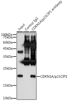 Immunoprecipitation analysis of 300ug extracts of MCF7 cells using 3ug CDKN1A/p21CIP1 Polyclonal Antibody. Western blot was performed from the immunoprecipitate using CDKN1A/p21CIP1 Polyclonal Antibody at a dilution of 1:500.