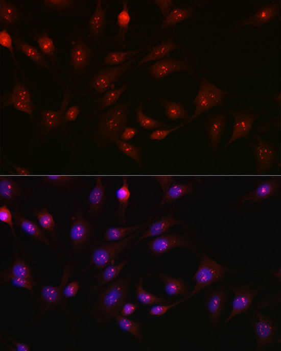 Immunofluorescence analysis of C6 cells using [KO Validated] PARP1 Polyclonal Antibody at dilution of 1:100 (40x lens). Blue: DAPI for nuclear staining.