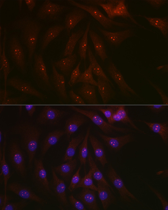 Immunofluorescence analysis of NIH-3T3 cells using [KO Validated] PARP1 Polyclonal Antibody at dilution of 1:100 (40x lens). Blue: DAPI for nuclear staining.