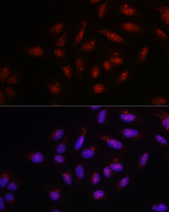 Immunofluorescence analysis of U2OS cells using [KO Validated] PARP1 Polyclonal Antibody at dilution of 1:100 (40x lens). Blue: DAPI for nuclear staining.