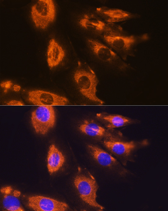 Immunofluorescence analysis of H9C2 cells using DAG1 Polyclonal Antibody at dilution of 1:100 (40x lens). Blue: DAPI for nuclear staining.