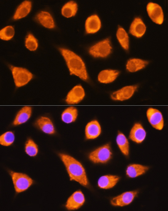 Immunofluorescence analysis of L929 cells using DAG1 Polyclonal Antibody at dilution of 1:100 (40x lens). Blue: DAPI for nuclear staining.