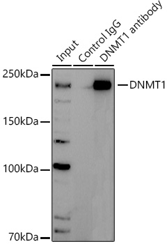 Immunoprecipitation analysis of 300ug extracts of Jurkat cells using 3ug DNMT1 Polyclonal Antibody. Western blot was performed from the immunoprecipitate using DNMT1 at a dilution of 1:1000.