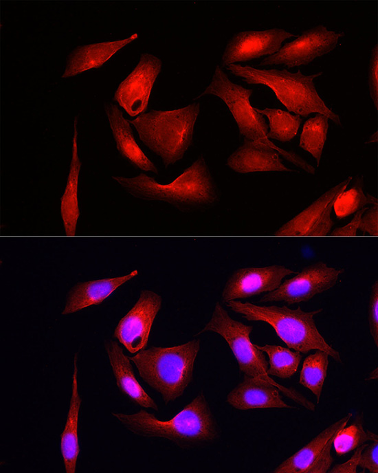 Immunofluorescence analysis of U2OS cells using eIF4EBP1 Polyclonal Antibody at dilution of 1:100 (40x lens). Blue: DAPI for nuclear staining.