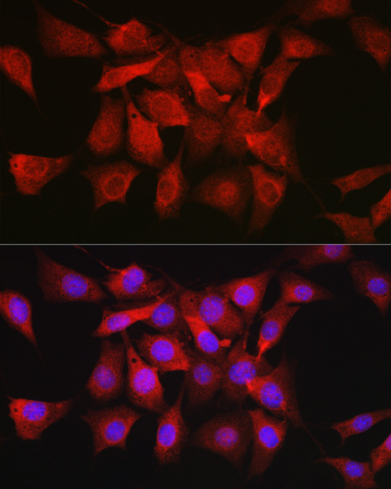 Immunofluorescence analysis of NIH/3T3 cells using [KO Validated] AKT1 Polyclonal Antibody at dilution of 1:50 (40x lens). Blue: DAPI for nuclear staining.