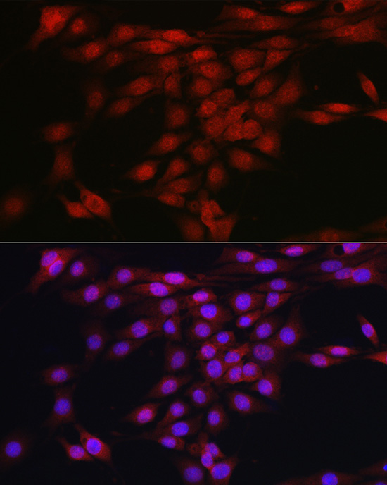 Immunofluorescence analysis of PC-12 cells using [KO Validated] AKT1 Polyclonal Antibody at dilution of 1:50 (40x lens). Blue: DAPI for nuclear staining.