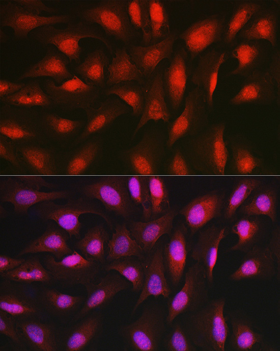 Immunofluorescence analysis of U2OS cells using [KO Validated] AKT1 Polyclonal Antibody at dilution of 1:50 (40x lens). Blue: DAPI for nuclear staining.