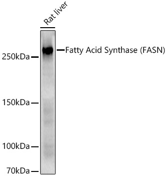 Western blot analysis of Rat liver using Fatty Acid Synthase Polyclonal Antibody at 1:1000 dilution.