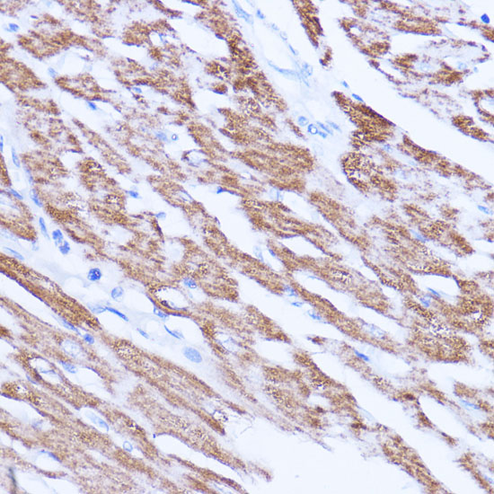 Immunohistochemistry of paraffin-embedded rat heart using SIRT3 Polyclonal Antibody at dilution of 1:100 (40x lens).Perform microwave antigen retrieval with 10 mM PBS buffer pH 7.2 before commencing with IHC staining protocol.